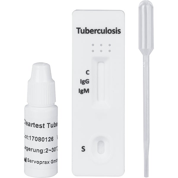 Najjasnejšia tuberkulóza