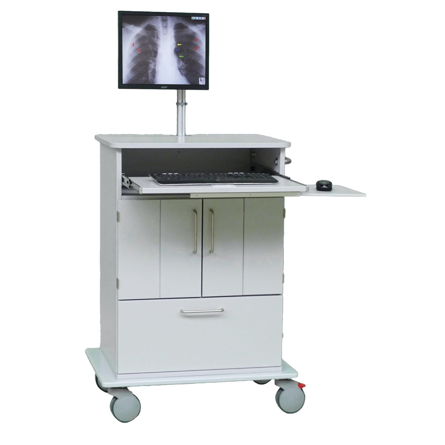 Vozík Novocal EDV má plnú plastovú dosku, počítačový monitor s röntgenovým snímkom hrudníka, výsuvný podnos pre klávesnicu a myš, pod ním ležiace úložné priehradky a kolieska pre ľahký transport výpočtovej techniky.