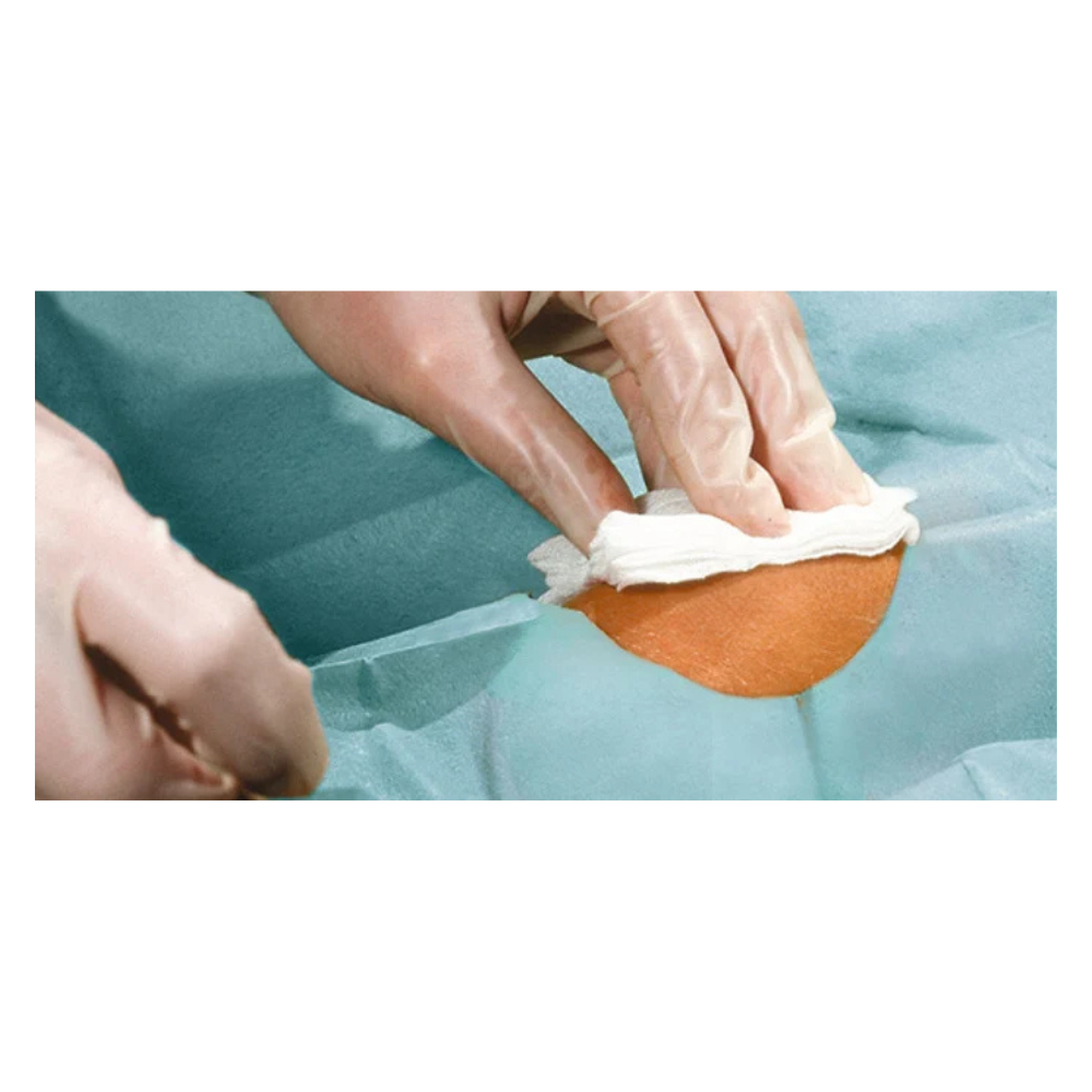 Detailný záber na ruky v rukaviciach, ktoré čistia malú oblasť pokožky bielou handričkou, obklopené modrozelenými Hartmann Foliodrape® Protect Lochtüchern, samolepiace, sterilné, jednotlivo balené, spoločnosti Paul Hartmann AG.