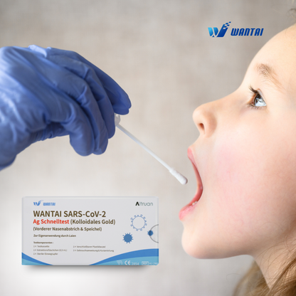 Zdravotnícky pracovník s modrou rukavicou sa pripravuje na to, aby odobral vzorku z úst dieťaťa pomocou Wantai SARS-CoV-2 rýchlotestu, Lollitest (Koloidné zlato) CE/2854, pre rýchly antigénový test. Balenie, ktoré je ideálne pre aplikácie v materských školách a školách, je v popredí dobre viditeľné.